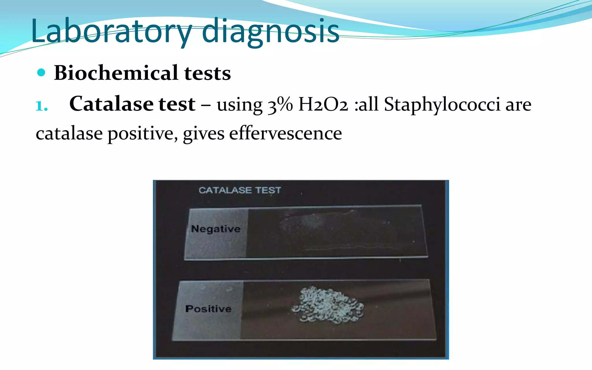 Laboratory diagnosis
 Biochemical tests
1. Catalase test – using 3% H2O2 :all Staphylococci are
catalase positive, gives effervescence
 