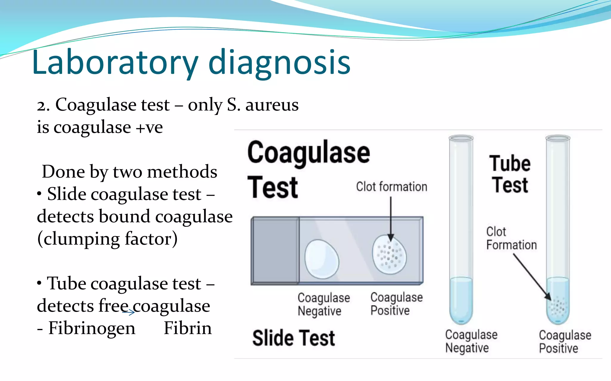 Laboratory diagnosis
2. Coagulase test – only S. aureus
is coagulase +ve
Done by two methods
• Slide coagulase test –
detects bound coagulase
(clumping factor)
• Tube coagulase test –
detects free coagulase
- Fibrinogen Fibrin
 