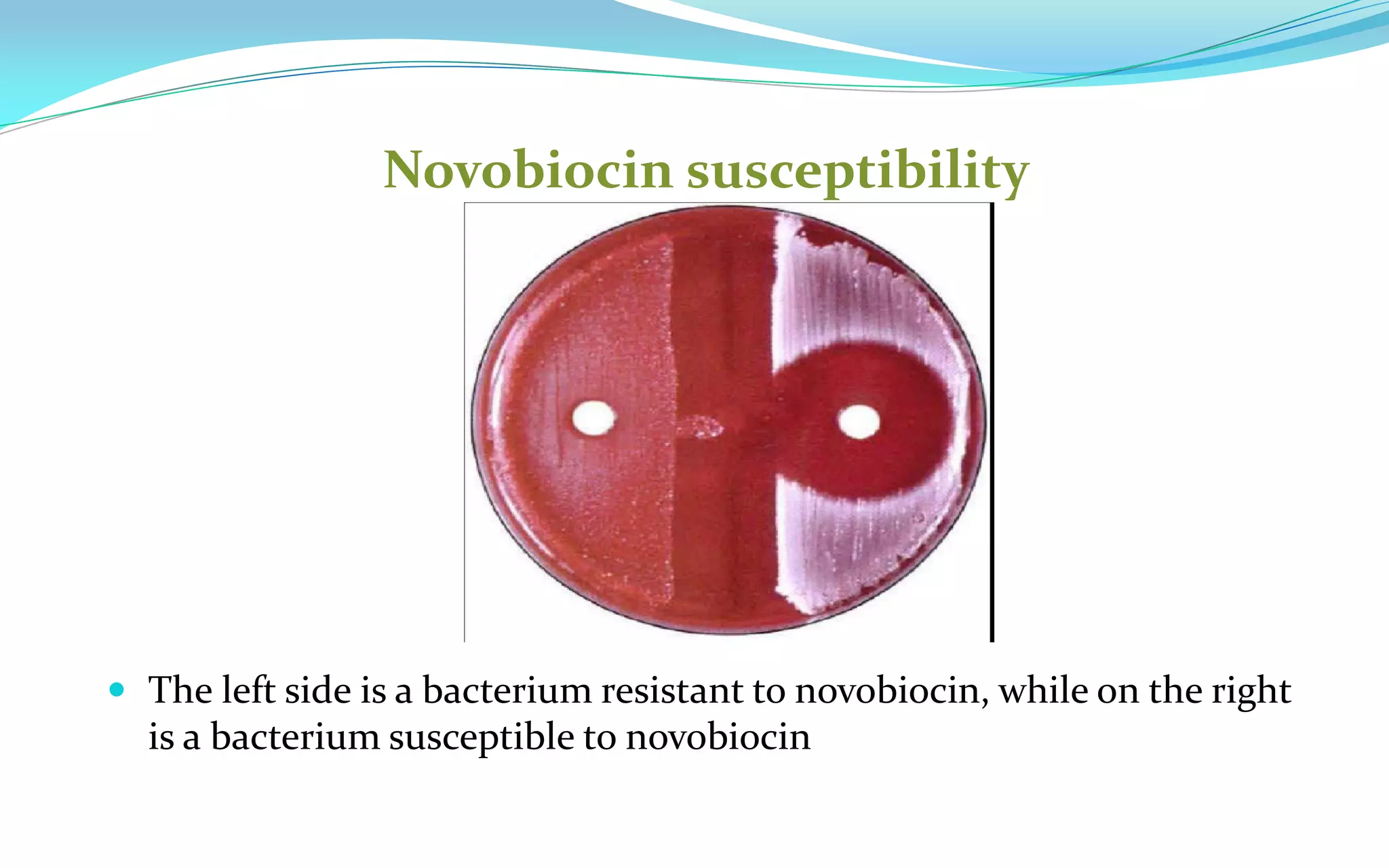 Novobiocin susceptibility
 The left side is a bacterium resistant to novobiocin, while on the right
is a bacterium susceptible to novobiocin
 