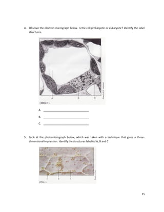 4. Observe the electron micrograph below. Is the cell prokaryotic or eukaryotic? Identify the label
structures.

A. _______________________________
B. _______________________________
C. _______________________________

5. Look at the photomicrograph below, which was taken with a technique that gives a threedimensional impression. Identify the structures labelled A, B and C

15

 
