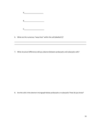 A______________________

B_______________________

C_______________________

6. What are the numerous “wavy lines” within the cell (labelled C)?
__________________________________________________________________________________
__________________________________________________________________________________

7. What structural differences did you observe between prokaryotic and eukaryotic cells?

8. Are the cells in the electron micrograph below prokaryotic or eukaryotic? How do you know?

16

 