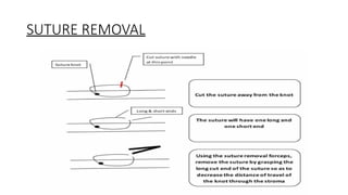 Comprehensive Guide to Basic Suturing Techniques and Wound Closure | PPTX