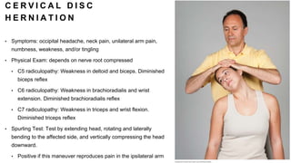 C E R V I C A L D I S C
H E R N I A T I O N
• Symptoms: occipital headache, neck pain, unilateral arm pain,
numbness, weakness, and/or tingling
• Physical Exam: depends on nerve root compressed
• C5 radiculopathy: Weakness in deltoid and biceps. Diminished
biceps reflex
• C6 radiculopathy: Weakness in brachioradialis and wrist
extension. Diminished brachioradialis reflex
• C7 radiculopathy: Weakness in triceps and wrist flexion.
Diminished triceps reflex
• Spurling Test: Test by extending head, rotating and laterally
bending to the affected side, and vertically compressing the head
downward.
• Positive if this maneuver reproduces pain in the ipsilateral arm
 