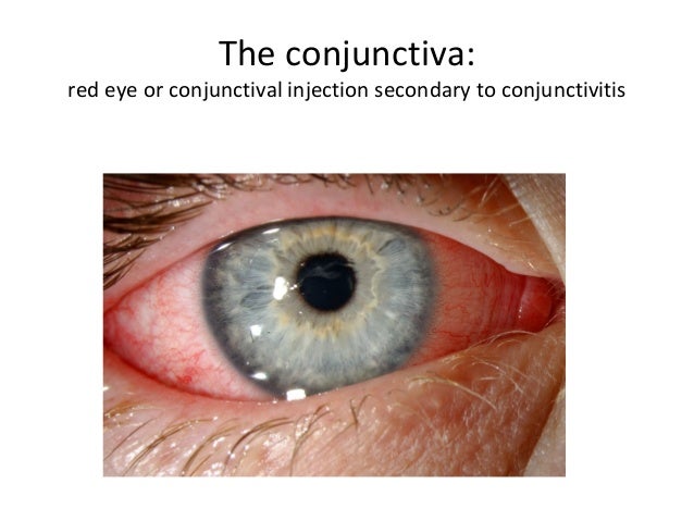 conjunctiva conjunctiva