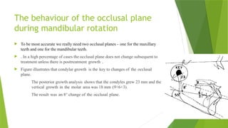 Maxillary Plane Rotation the rotation of mandible resulting from growth.pptx