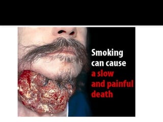 3 the truth about tobacco