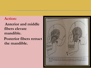 Action:
Anterior and middle
fibers elevate
mandible.
Posterior fibers retract
the mandible.
 