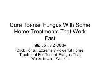 Cure Toenail Fungus With Some
Home Treatments That Work
Fast
http://bit.ly/2rO6klv
Click For an Extremely Powerful Home
Treatment For Toenail Fungus That
Works In Just Weeks.
 