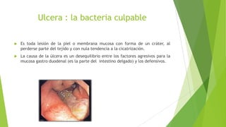 Ulcera : la bacteria culpable


Es toda lesión de la piel o membrana mucosa con forma de un cráter, al
perderse parte del tejido y con nula tendencia a la cicatrización.



La causa de la úlcera es un desequilibrio entre los factores agresivos para la
mucosa gastro duodenal (es la parte del intestino delgado) y los defensivos.

 