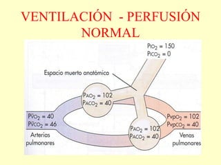 VENTILACIÓN - PERFUSIÓN
NORMAL
 