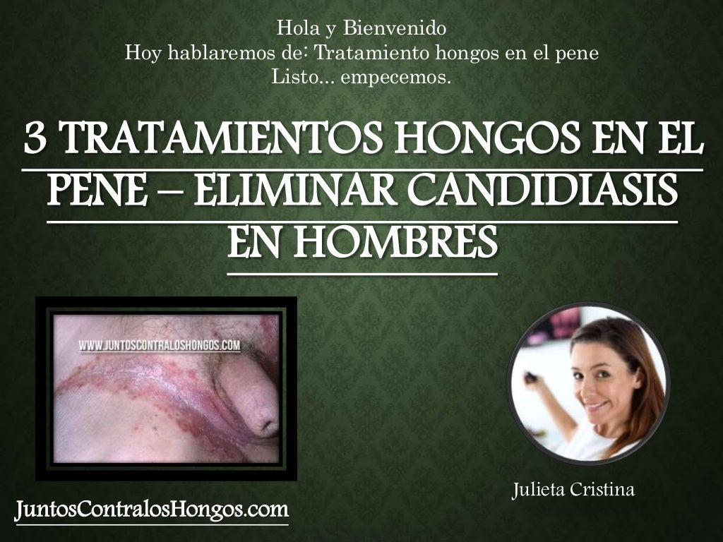 Manchas En El Pene Qu Es La Balanitis S ntomas Y Tratamiento CZCKYQ Manchas En El Pene Qu Es La Balanitis S ntomas Y Tratamiento CZCKYQ