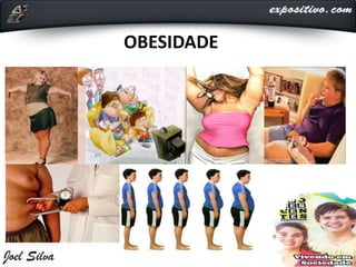 OBESIDADE
 