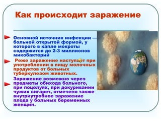 Как происходит заражение
Основной источник инфекции —
больной открытой формой, у
которого в капле мокроты
содержится до 2-3 миллионов
микобактерий
Реже заражение наступает при
употреблении в пищу молочных
продуктов от больных
туберкулезом животных.
Заражение возможно через
предметы обихода больного,
при поцелуях, при докуривании
чужих сигарет, отмечено также
внутриутробное заражение
плода у больных беременных
женщин.
 