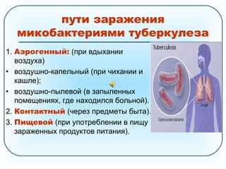 1. Аэрогенный: (при вдыхании
воздуха)
• воздушно-капельный (при чихании и
кашле);
• воздушно-пылевой (в запыленных
помещениях, где находился больной).
2. Контактный (через предметы быта).
3. Пищевой (при употреблении в пищу
зараженных продуктов питания).
пути заражения
микобактериями туберкулеза
 