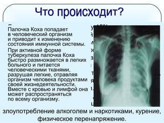Болезнь развивается лишь у 15% процентов лиц,
заразившихся микобактерией туберкулеза. Главной
причиной этого является снижение иммунитета. К
факторам, снижающим уровень иммунитета,
относятся: простудные заболевания, грипп,
инфекционные заболевания (ветряная оспа, корь,
коклюш), хронический бронхит, бронхиальная астма,
сахарный диабет, язвенная болезнь желудка и
двенадцатиперстной кишки. СПИД, применение
гормональных препаратов для лечения других
заболеваний, неполноценное питание,
злоупотребление алкоголем и наркотиками, курение,
физическое перенапряжение.
Палочка Коха попадает
в человеческий организм
и приводит к изменению
состояния иммунной системы.
При активной форме
туберкулеза палочка Коха
быстро размножается в легких
больного и питается
человеческими тканями,
разрушая легкие, отравляя
организм человека продуктами
своей жизнедеятельности.
Вместе с кровью и лимфой она
может распространяться
по всему организму.
 