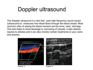 Doppler ultrasound The Doppler ultrasound is a test that  uses high frequency sound waves (ultrasound) to  measures how blood flows through the blood vessel. Most common sites of seeing the blood moment are the arms, neck, and legs. This test helps to show blockage or narrowing of vessels. it also detects injuries to arteries and it can also monitor certain treatments to your veins and arteries. 
