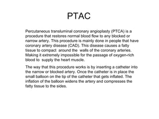 PTAC Percutaneous transluminal coronary angioplasty (PTCA) is a procedure that restores normal blood flow to any blocked or narrow artery. This procedure is mainly done in people that have coronary artery disease (CAD). This disease causes a fatty tissue to compact  around the  walls of the coronary arteries. Making it extremely impossible for the passage of oxygen-rich blood to  supply the heart muscle.  The way that this procedure works is by inserting a catheter into the narrow or blocked artery. Once the catheter is in place the  small balloon on the tip of the catheter that gets inflated. The inflation of the balloon widens the artery and compresses the fatty tissue to the sides.  
