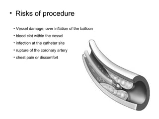 Risks of procedure Vessel damage, over inflation of the balloon blood clot within the vessel  infection at the catheter site rupture of the coronary artery chest pain or discomfort 