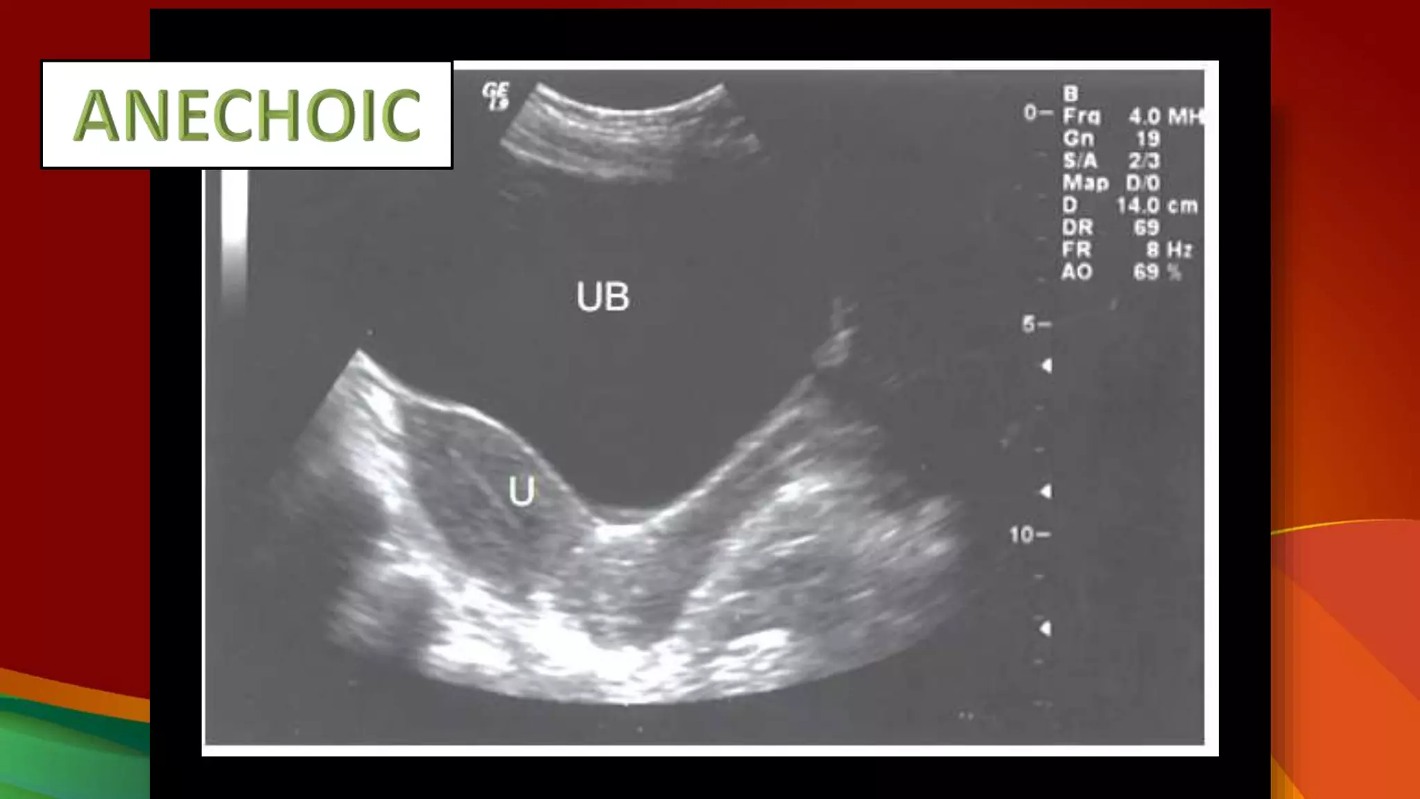 3 ultrasound nomenclature | PPTX
