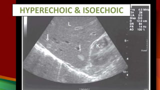 3 ultrasound nomenclature | PPTX
