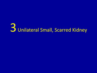 3Unilateral Small, Scarred Kidney
 