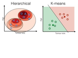 Hierarchical K-means
Tumour size
Age
Tumour size
Age
 