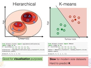 😈👼
Tumour size
Age
Tumour size
Age
Hierarchical K-means
Slow for modern size datasets
Hard to predict K
Good for visualisation purposes
 