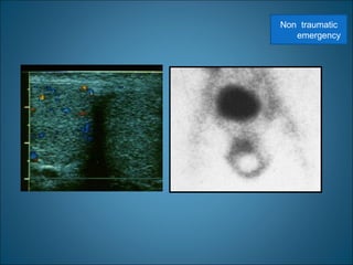 Non traumatic
emergency
 