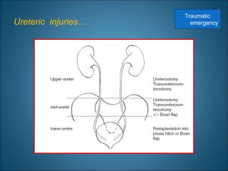 Ureteric injuries…
Traumatic
emergency
 