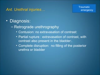 Ant. Urethral injuries…
• Diagnosis:
– Retrograde urethrography
• Contusion: no extravasation of contrast:
• Partial rupture : extravasation of contrast, with
contrast also present in the bladder:.
• Complete disruption: no filling of the posterior
urethra or bladder
Traumatic
emergency
 