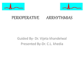 PERIOPERATIVE ARRHYTHMIAS
Guided By- Dr. Vijeta khandelwal
Presented By-Dr. C.L. khedia
 