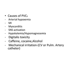 Perioperative%20%20%20%20%20%20%20%20 arrhythmias | PPTX