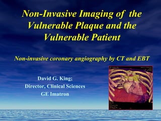 Non-Invasive Imaging of the
Vulnerable Plaque and the
Vulnerable Patient
Non-invasive coronary angiography by CT and EBT
David G. King;
Director, Clinical Sciences
GE Imatron
 