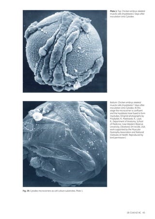 18-1140-62 AC 45
Plate 1: Top: Chicken embryo skeletal
muscle cells (myoblasts) 2 days after
inoculation onto Cytodex.
Bottom: Chicken embryo skeletal
muscle cells (myoblasts) 7 days after
inoculation onto Cytodex. At this
stage the microcarrier is confluent
and the myoblasts have fused to form
myotubes. (Original photographs by
Przybylski, R., Pawlowski, R., Loyd,
R., Department of Anatomy, School
of Medicine, Case Western Reserve
University, Cleveland, OH 44106, USA;
work supported by the Muscular
Dystrophy Association and National
Institutes of Health. Reproduced by
kind permission.)
Fig. 29. Cytodex microcarriers as cell culture substrates. Plate 1.
 