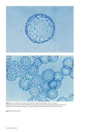 46 18-1140-62 AC
Plate 2: Top: A confluent monolayer of mouse brain capillary endothelial cells on Cytodex 3.
Bottom: Bovine pulmonary artery endothelial cell growing on Cytodex 3. (Original photographs by Busch, C.,
Department of Pathology, University of Uppsala, Uppsala, Sweden. Reproduced by kind permission.)
Fig. 29. continued. Plate 2.
 