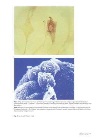 18-1140-62 AC 47
Plate 3: Top: Demonstration of insulin synthesis by immunostaining of fetal rat pancreas cell growing on Cytodex 3. (Original
photographs by Bone, A., Swenne, I., Department of Medical Cell Biology, Biomedical Centre, Uppsala, Sweden. Reproduced by kind
permission.)
Plate 4: Bottom: Scanning electron micrograph of human lymphoblastoid cells proliferating on Cytodex. (Original photographs by
Christie, W., Gallacher, A., MRC Clinical and Population Cytogenetics Unit, Western General Hospital, Edinburgh EH4 2XU, Scotland.
Reproduced by kind permission.)
Fig. 29. continued. Plates 3 and 4.
 