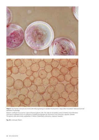 48 18-1140-62 AC
Plate 5: Top: Human cervical carcinoma cells (HeLa) growing on Cytodex microcarriers 3 days after inoculation. Note pronounced
epithelial morphology.
Bottom: Confluent microcarrier culture of human glioma cells. The cells do not exhibit contact inhibition of proliferation
and hence multilayers form at confluence. (Original photographs by Pharmacia Fine Chemicals, Uppsala, Sweden.
The glioma cells were kindly supplied by K. Nilsson, Wallenberg Laboratory, Uppsala, Sweden.)
Fig. 29. continued. Plate 5.
 