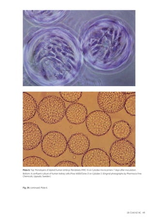 18-1140-62 AC 49
Plate 6: Top: Monolayers of diploid human embryo fibroblasts (MRC-5) on Cytodex microcarriers 7 days after inoculation.
Bottom: A confluent culture of human kidney cells (Flow 4000/Clone 2) on Cytodex 3. (Original photographs by Pharmacia Fine
Chemicals, Uppsala, Sweden.)
Fig. 29. continued. Plate 6.
 