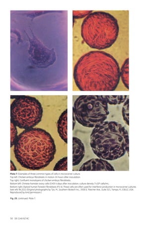 50 18-1140-62 AC
Plate 7: Examples of three common types of cells in microcarrier culture.
Top left: Chicken embryo fibroblasts in motion 24 hours after inoculation.
Top right: Confluent monolayers of chicken embryo fibroblasts.
Bottom left: Chinese hamster ovary cells (CHO) 4 days after inoculation, culture density 7×106 cells/mL.
Bottom right: Diploid human foreskin fibroblasts (FS-4). These cells are often used for interferon production in microcarrier cultures
(see refs 94,101). (Original photographs by Tyo, M., Southern Biotech Inc., 3500 E. Fletcher Ave., Suite 321, Tampa, FL 33612, USA.
Reproduced by kind permission.)
Fig. 29. continued. Plate 7.
 