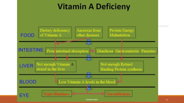 Vitamin A deficiency disorders | PPTX