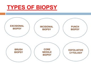 TYPES OF BIOPSY
EXCISIONAL
BIOPSY
INCISIONAL
BIOPSY
PUNCH
BIOPSY
CORE
NEEDLE
BIOPSY
EXFOLIATIVE
CYTOLOGY
BRUSH
BIOPSY
USH BIOPSY
 