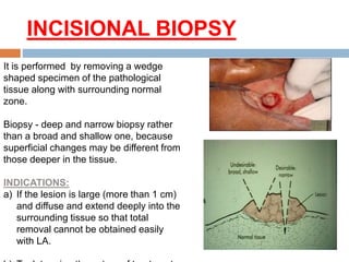 INCISIONAL BIOPSY
It is performed by removing a wedge
shaped specimen of the pathological
tissue along with surrounding normal
zone.
Biopsy - deep and narrow biopsy rather
than a broad and shallow one, because
superficial changes may be different from
those deeper in the tissue.
INDICATIONS:
a) If the lesion is large (more than 1 cm)
and diffuse and extend deeply into the
surrounding tissue so that total
removal cannot be obtained easily
with LA.
 