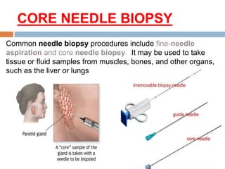 CORE NEEDLE BIOPSY
Common needle biopsy procedures include fine-needle
aspiration and core needle biopsy. It may be used to take
tissue or fluid samples from muscles, bones, and other organs,
such as the liver or lungs
 