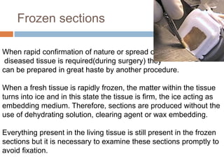 Frozen sections
When rapid confirmation of nature or spread of
diseased tissue is required(during surgery) they
can be prepared in great haste by another procedure.
When a fresh tissue is rapidly frozen, the matter within the tissue
turns into ice and in this state the tissue is firm, the ice acting as
embedding medium. Therefore, sections are produced without the
use of dehydrating solution, clearing agent or wax embedding.
Everything present in the living tissue is still present in the frozen
sections but it is necessary to examine these sections promptly to
avoid fixation.
 