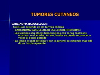 TUMORES CUTANEOS  CARCINOMA BASOCELULAR: . CLINICA: depende de las formas clínicas - CARCINOMA BASOCELULAR ESCLERODERMIFOR...