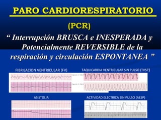 PARO CARDIORESPIRATORIO
                   (PCR)
“ Interrupción BRUSCA e INESPERADA y
     Potencialmente REVERSIBLE de la
 respiración y circulación ESPONTANEA ”
  FIBRILACION VENTRICULAR (FV)   TAQUICARDIA VENTRICULAR SIN PULSO (TVSP)




           ASISTOLIA               ACTIVIDAD ELECTRICA SIN PULSO (AESP)
 