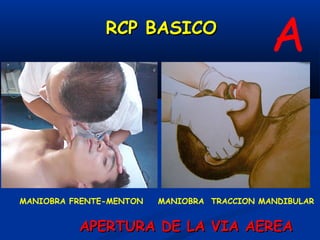 RCP BASICO
                                             A
A
MANIOBRA FRENTE-MENTON   MANIOBRA TRACCION MANDIBULAR


          APERTURA DE LA VIA AEREA
 