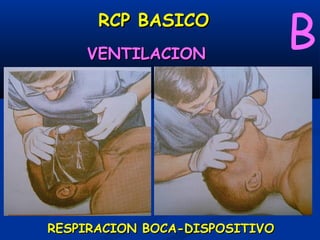 RCP BASICO
    VENTILACION
                               B


RESPIRACION BOCA-DISPOSITIVO
 