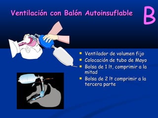 Ventilación con Balón Autoinsuflable
                                                  B
                       Ventilador de volumen fijo
                       Colocación de tubo de Mayo
                       Bolsa de 1 lt, comprimir a la
                        mitad
                       Bolsa de 2 lt comprimir a la
                        tercera parte
 