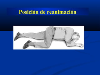 Posición de reanimación
 